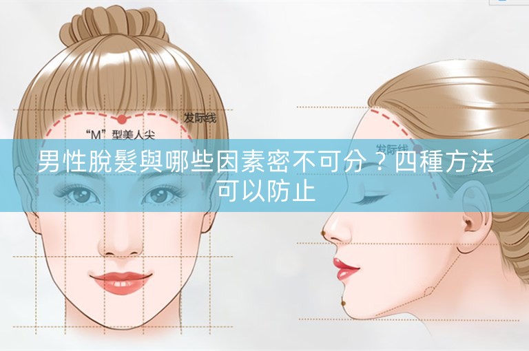 男性脫髮與哪些因素密不可分？四種方法可以防止