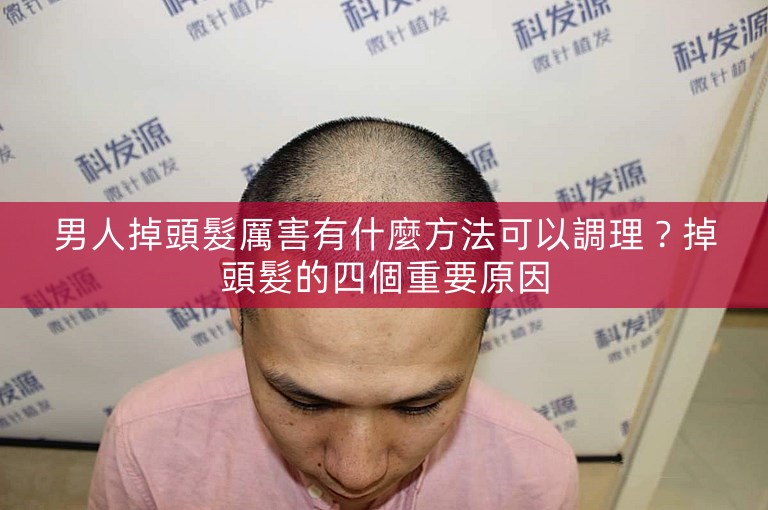 男人掉頭髮厲害有什麼方法可以調理？掉頭髮的四個重要原因