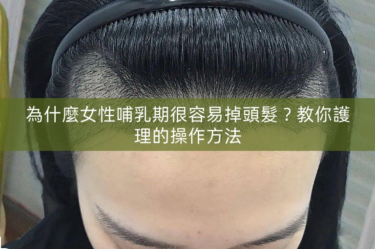 為什麼女性哺乳期很容易掉頭髮?教你護理的操作方法 為什麼女性哺乳期很容易掉頭髮?教你護理的操作方法