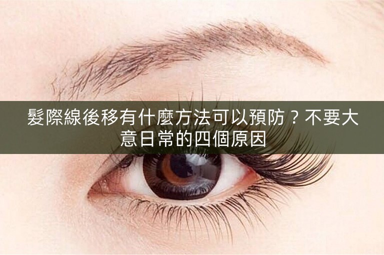 髮際線後移有什麼方法可以預防？不要大意日常的四個原因