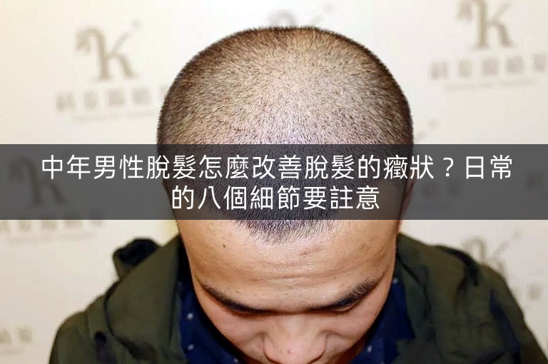 中年男性脫髮怎麼改善脫髮的癥狀？日常的八個細節要註意