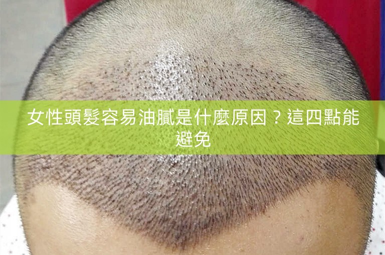 女性頭髮容易油膩是什麼原因?這四點能避免 女性頭髮容易油膩是什麼原因?這四點能避免