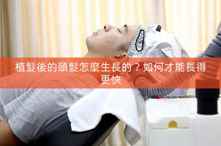 植髮後的頭髮怎麼生長的？如何才能長得更快