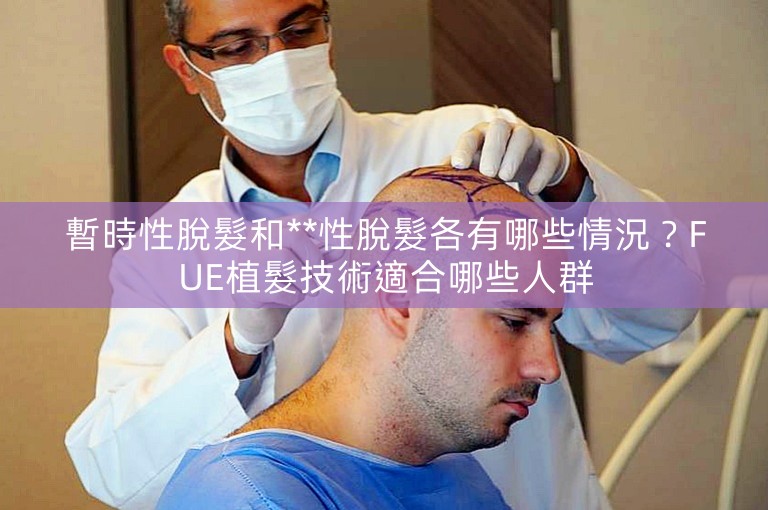 暫時性脫髮和**性脫髮各有哪些情況？FUE植髮技術適合哪些人群