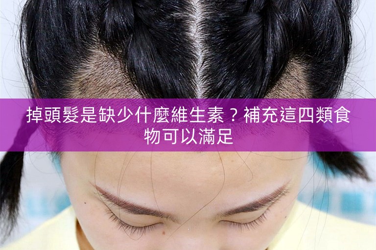 掉頭髮是缺少什麼維生素？補充這四類食物可以滿足