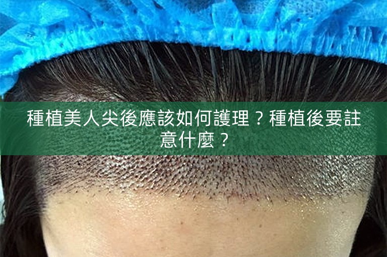 種植美人尖後應該如何護理？種植後要註意什麼？