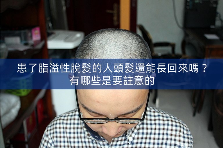 患了脂溢性脫髮的人頭髮還能長回來嗎？有哪些是要註意的