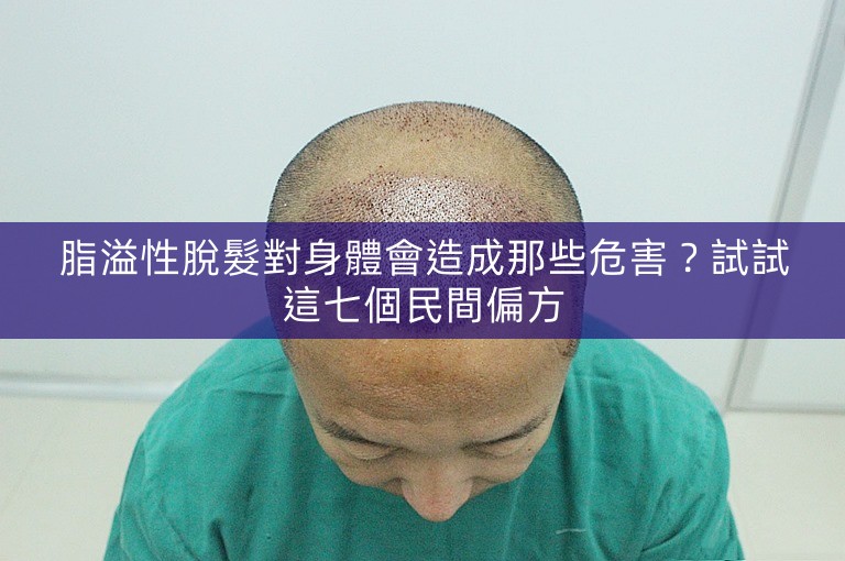 脂溢性脫髮對身體會造成那些危害？試試這七個民間偏方