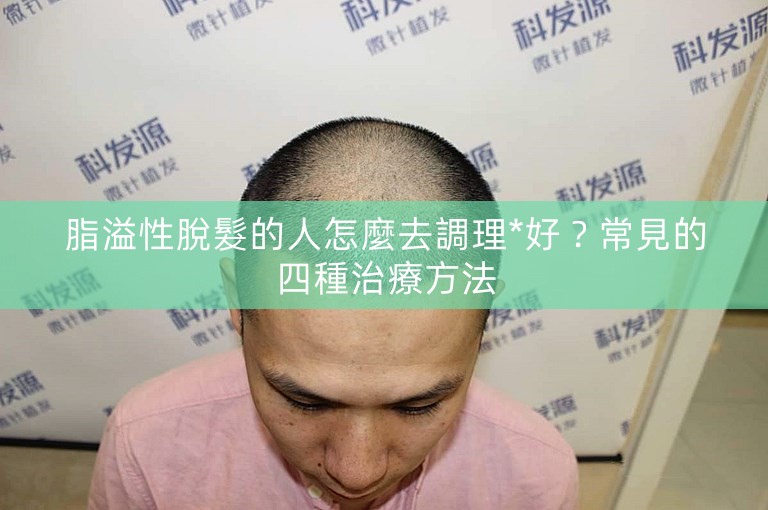 脂溢性脫髮的人怎麼去調理*好？常見的四種治療方法
