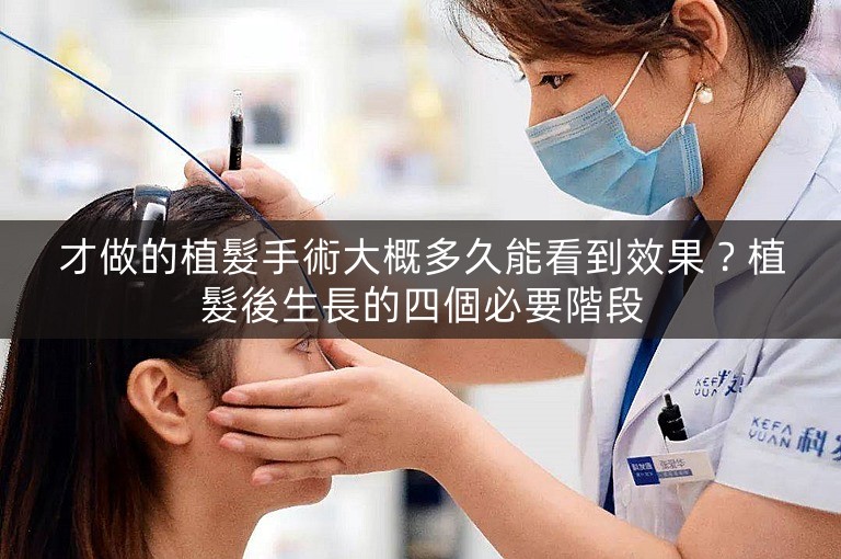才做的植髮手術大概多久能看到效果？植髮後生長的四個必要階段