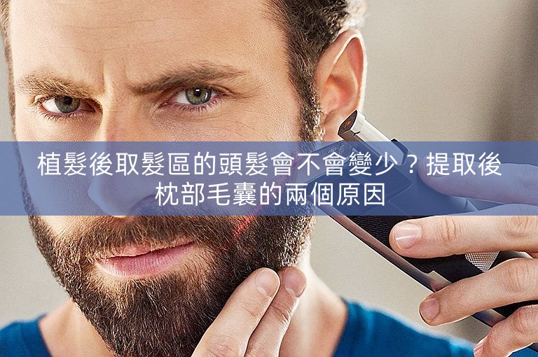 植髮後取髮區的頭髮會不會變少？提取後枕部毛囊的兩個原因