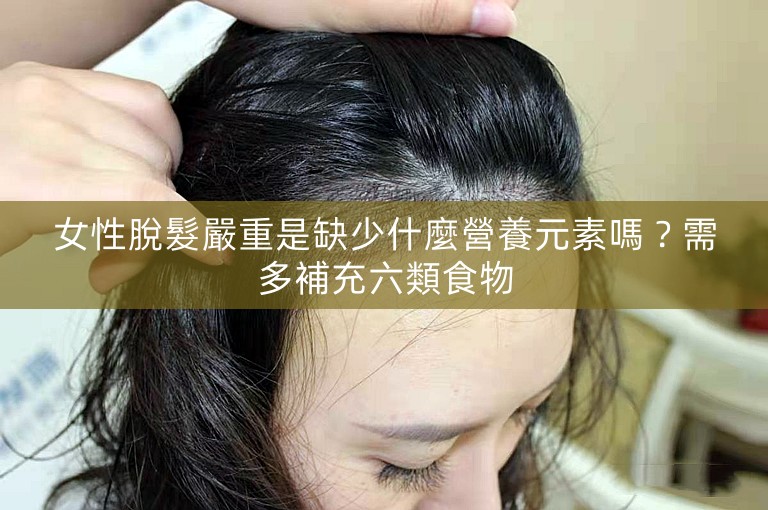 女性脫髮嚴重是缺少什麼營養元素嗎？需多補充六類食物
