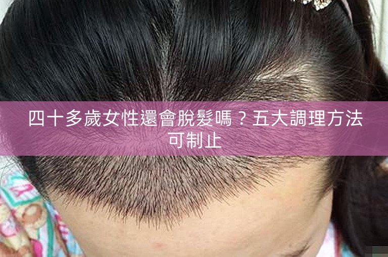 四十多歲女性還會脫髮嗎？五大調理方法可制止