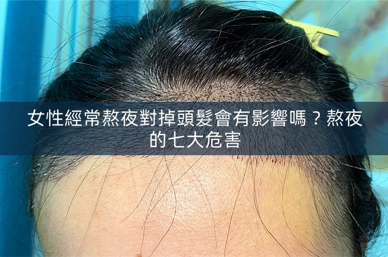 女性經常熬夜對掉頭髮會有影響嗎？熬夜的七大危害