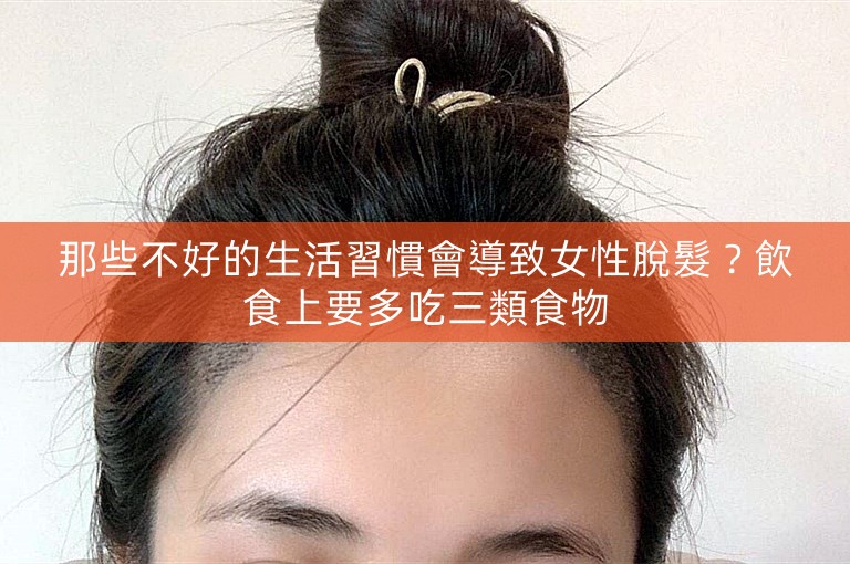 那些不好的生活習慣會導致女性脫髮？飲食上要多吃三類食物