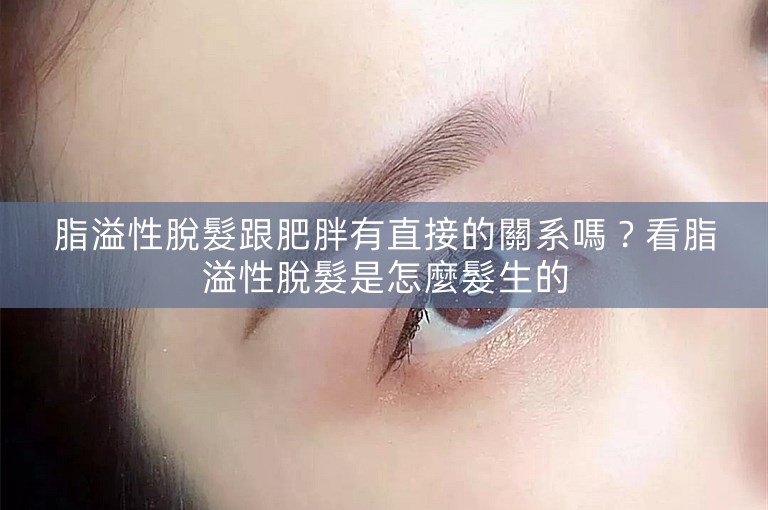 脂溢性脫髮跟肥胖有直接的關系嗎？看脂溢性脫髮是怎麼髮生的