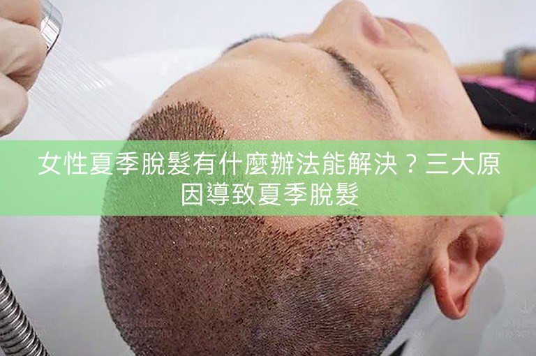 女性夏季脫髮有什麼辦法能解決？三大原因導致夏季脫髮