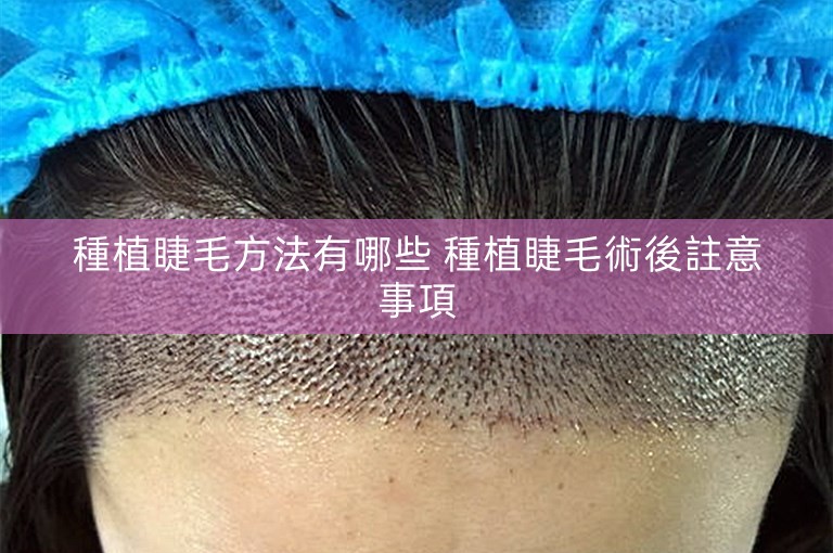 種植睫毛方法有哪些 種植睫毛術後註意事項