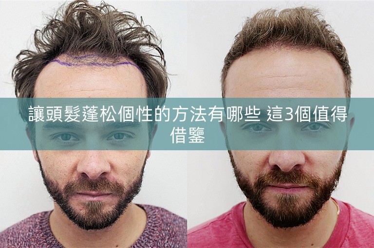 讓頭髮蓬松個性的方法有哪些 這3個值得借鑒