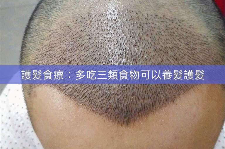 護髮食療：多吃三類食物可以養髮護髮