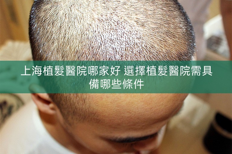 上海植髮醫院哪家好 選擇植髮醫院需具備哪些條件