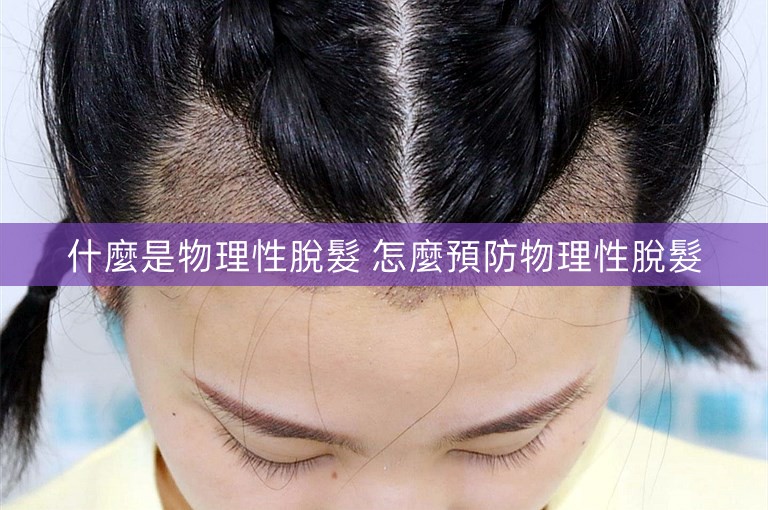 什麼是物理性脫髮 怎麼預防物理性脫髮
