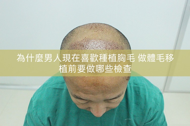 為什麼男人現在喜歡種植胸毛 做體毛移植前要做哪些檢查