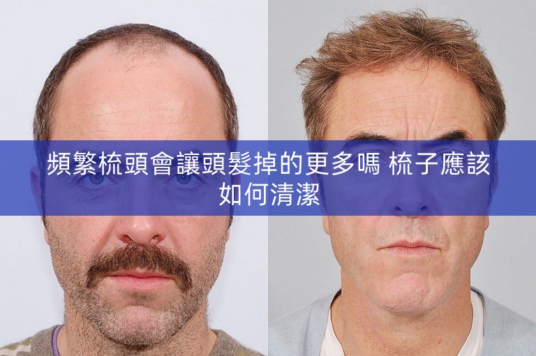 頻繁梳頭會讓頭髮掉的更多嗎 梳子應該如何清潔