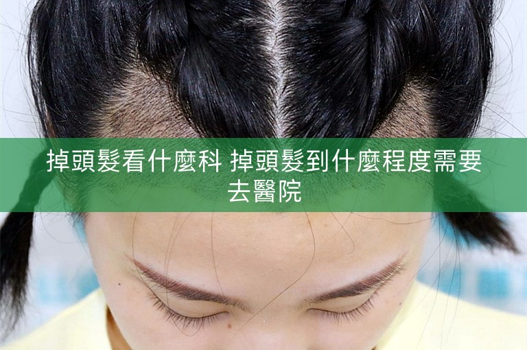 掉頭髮看什麼科 掉頭髮到什麼程度需要去醫院