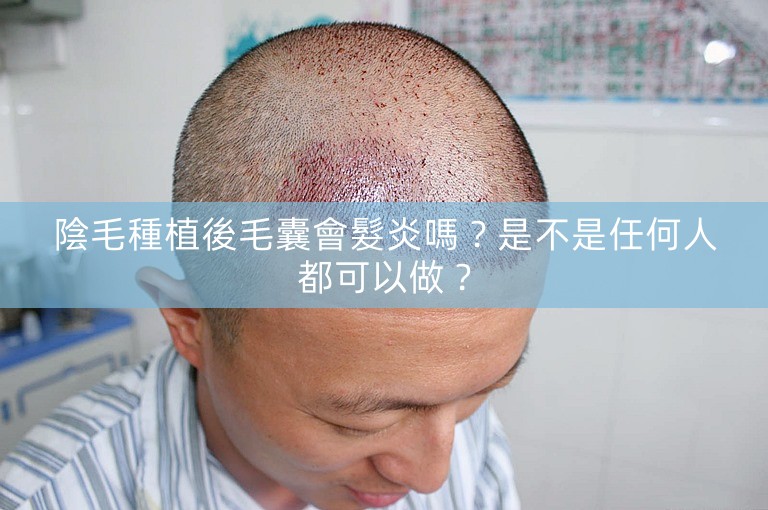 陰毛種植後毛囊會髮炎嗎?是不是任何人都可以做? 陰毛種植後毛囊會髮炎嗎?是不是任何人都可以做?