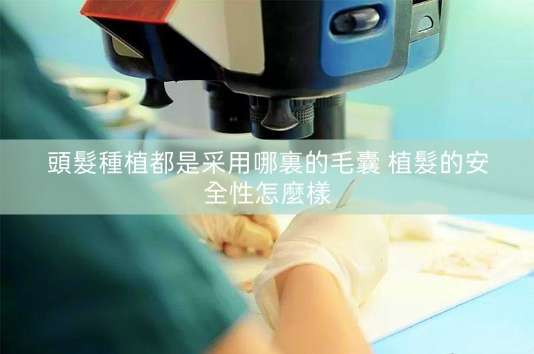 頭髮種植都是采用哪裏的毛囊 植髮的安全性怎麼樣