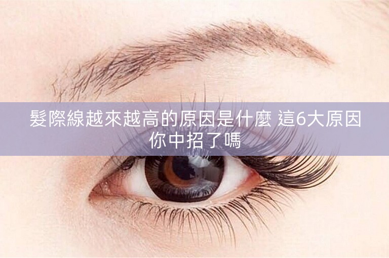 髮際線越來越高的原因是什麼 這6大原因你中招了嗎