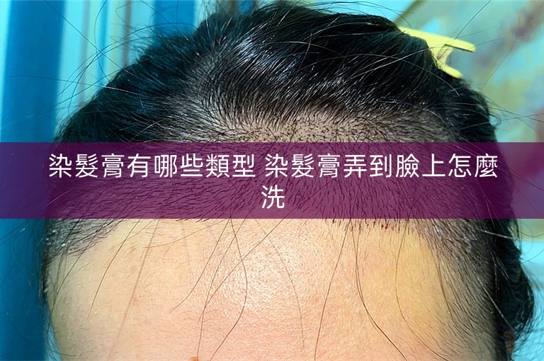 染髮膏有哪些類型 染髮膏弄到臉上怎麼洗