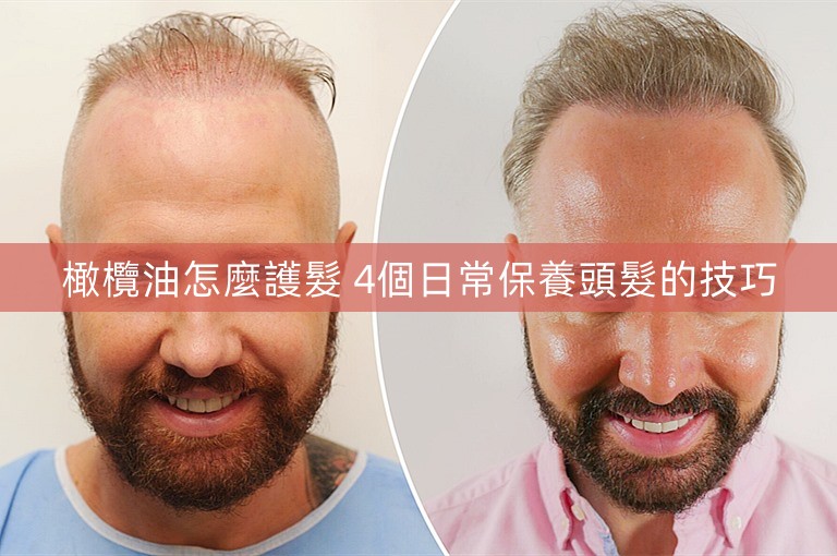 橄欖油怎麼護髮 4個日常保養頭髮的技巧