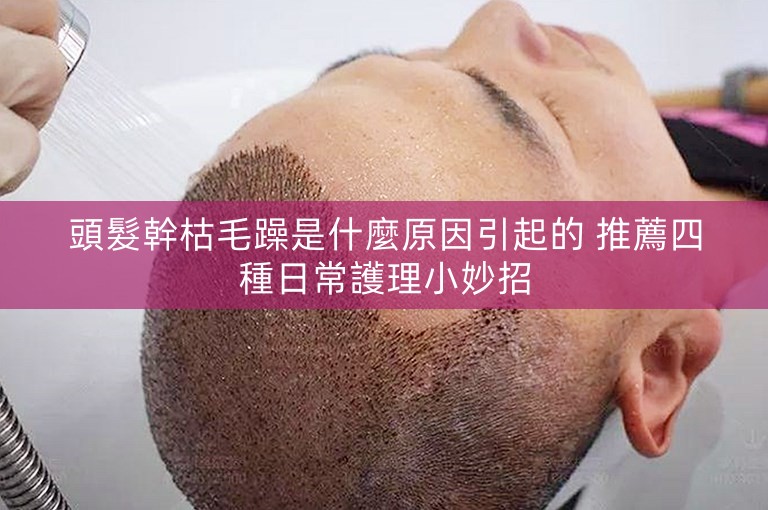 頭髮幹枯毛躁是什麼原因引起的 推薦四種日常護理小妙招