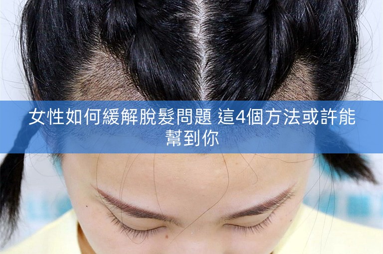 女性如何緩解脫髮問題 這4個方法或許能幫到你 女性如何緩解脫髮問題 這4個方法或許能幫到你