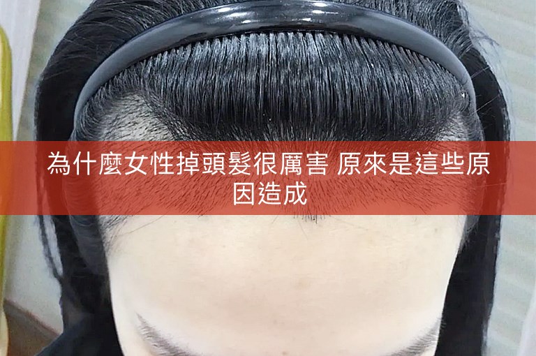 為什麼女性掉頭髮很厲害 原來是這些原因造成