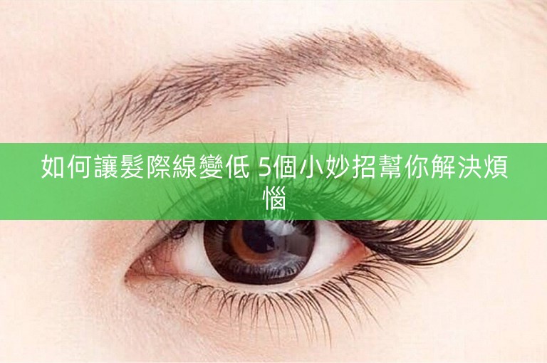 如何讓髮際線變低 5個小妙招幫你解決煩惱