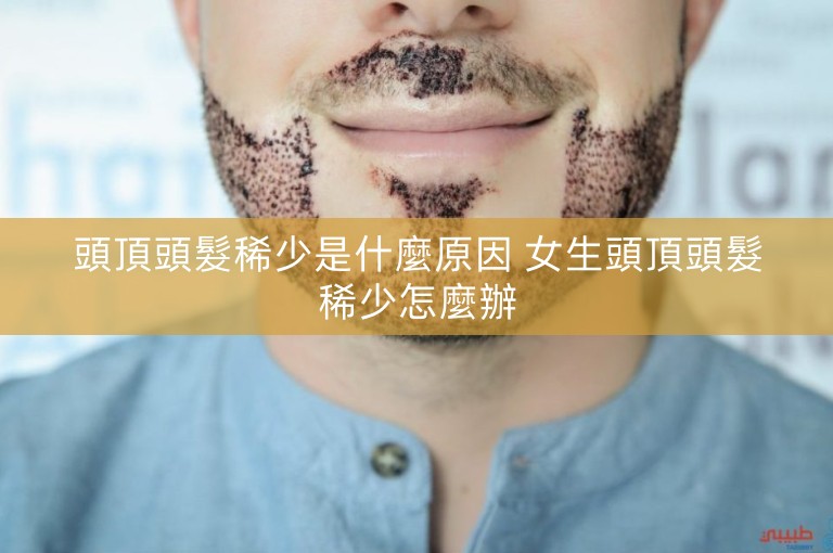 頭頂頭髮稀少是什麼原因 女生頭頂頭髮稀少怎麼辦