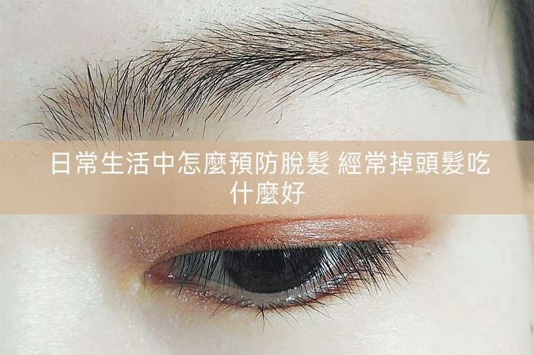 日常生活中怎麼預防脫髮 經常掉頭髮吃什麼好