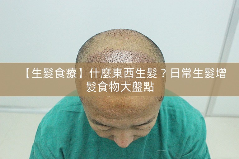 【生髮食療】什麼東西生髮？日常生髮增髮食物大盤點