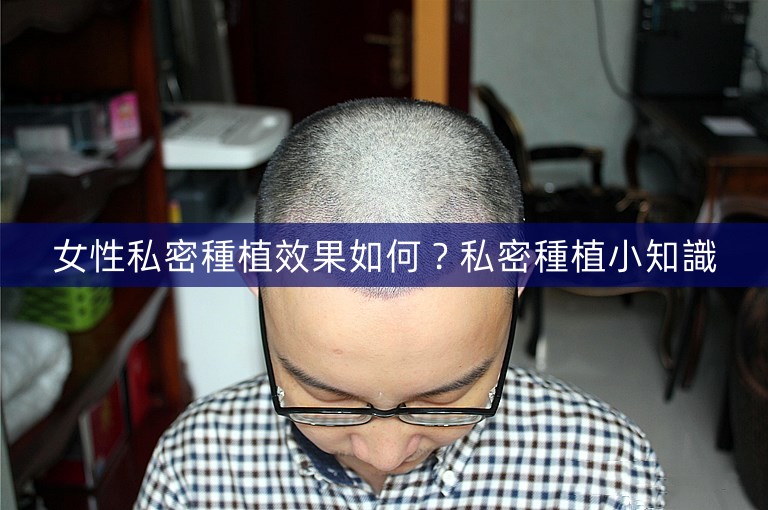 女性私密種植效果如何？私密種植小知識