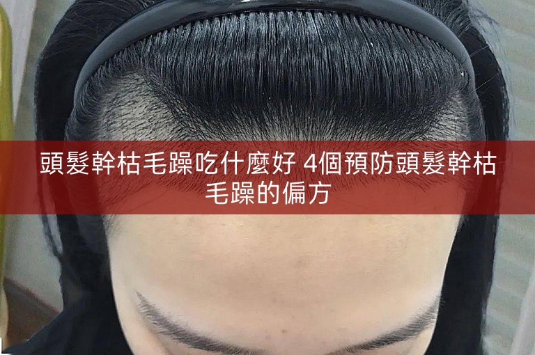 頭髮幹枯毛躁吃什麼好 4個預防頭髮幹枯毛躁的偏方 頭髮幹枯毛躁吃什麼好 4個預防頭髮幹枯毛躁的偏方