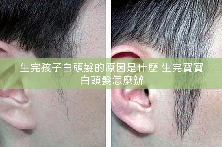 生完孩子白頭髮的原因是什麼 生完寶寶白頭髮怎麼辦