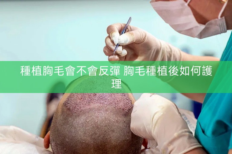 種植胸毛會不會反彈 胸毛種植後如何護理 種植胸毛會不會反彈 胸毛種植後如何護理