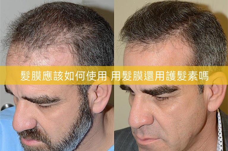 髮膜應該如何使用 用髮膜還用護髮素嗎