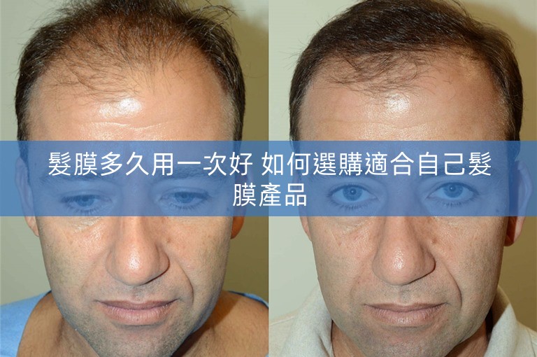 髮膜多久用一次好 如何選購適合自己髮膜產品 髮膜多久用一次好 如何選購適合自己髮膜產品