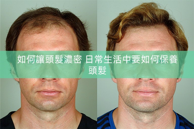 如何讓頭髮濃密 日常生活中要如何保養頭髮 如何讓頭髮濃密 日常生活中要如何保養頭髮