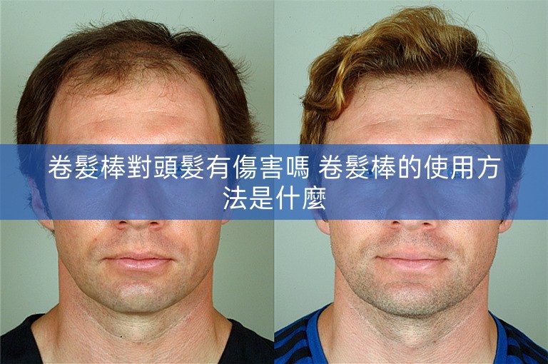 卷髮棒對頭髮有傷害嗎 卷髮棒的使用方法是什麼 卷髮棒對頭髮有傷害嗎 卷髮棒的使用方法是什麼