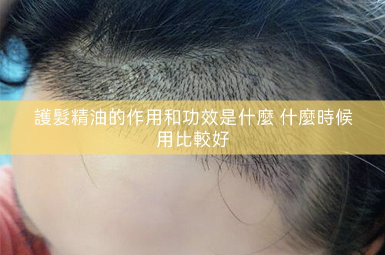 護髮精油的作用和功效是什麼 什麼時候用比較好